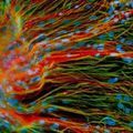neural–stem–cells.jpg
