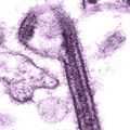 ebola–virus–invitro.jpg