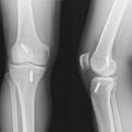 xray–bones–ligament.jpg