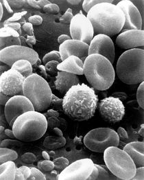 myeloid-leukaemia-slowed-mice.jpg