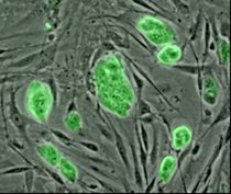 stem–cell.jpg
