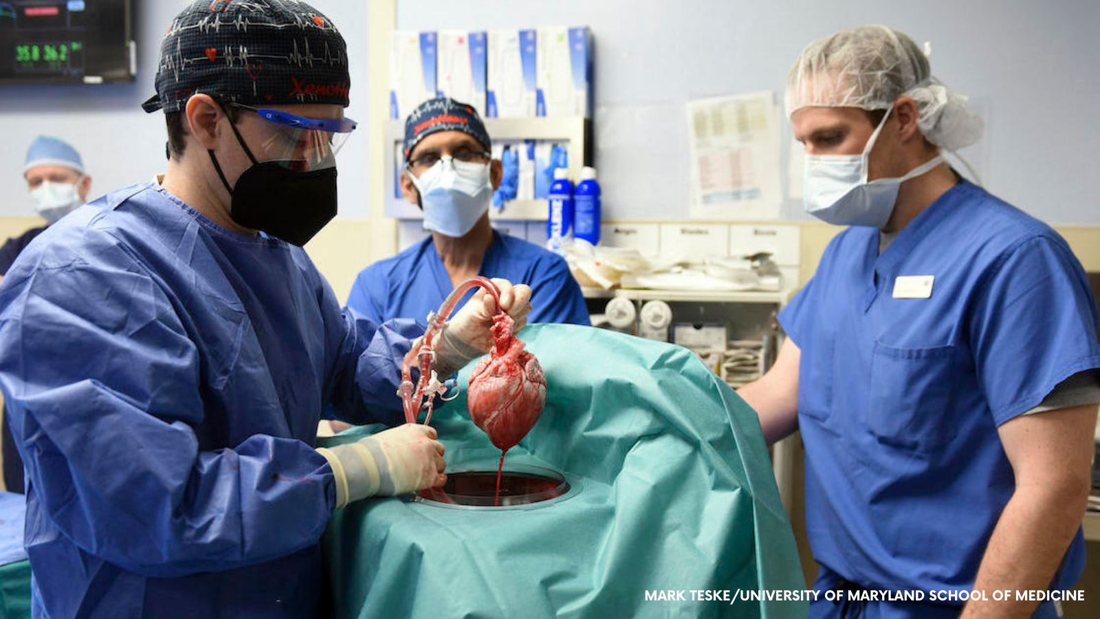 Pig to human heart transplant