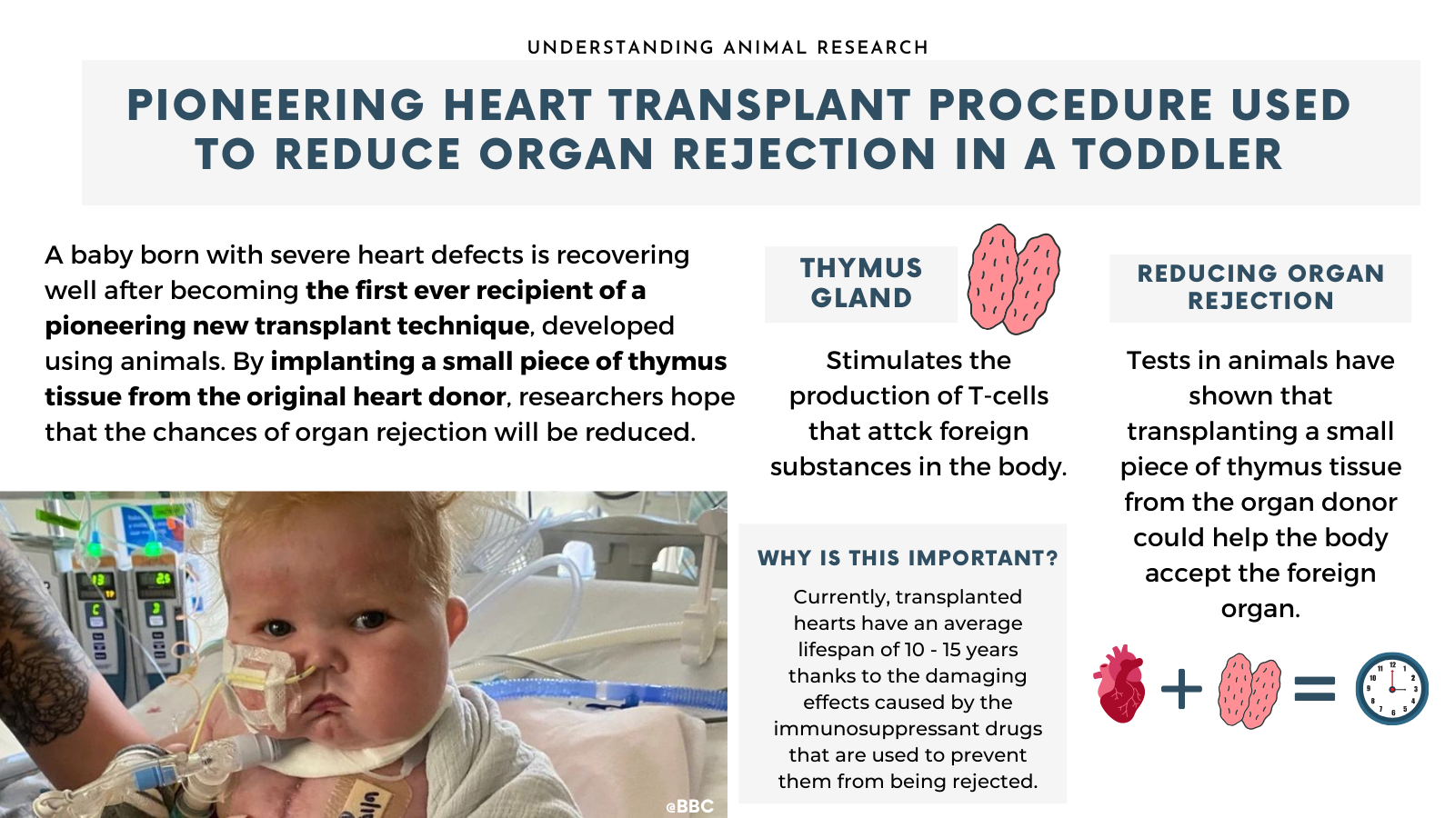 thymus heart transplant child animal testing