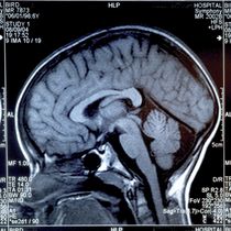 brain–injury–xray.jpg