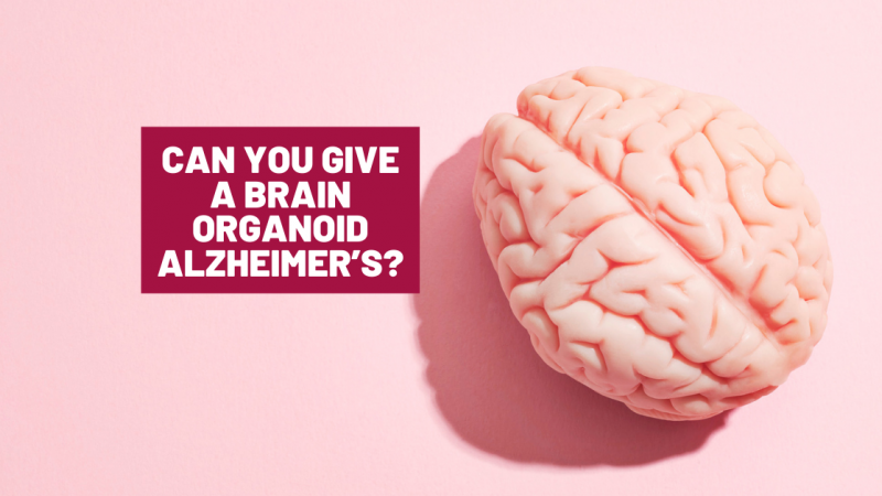 Can you give a brain organoid Alzheimer’s?