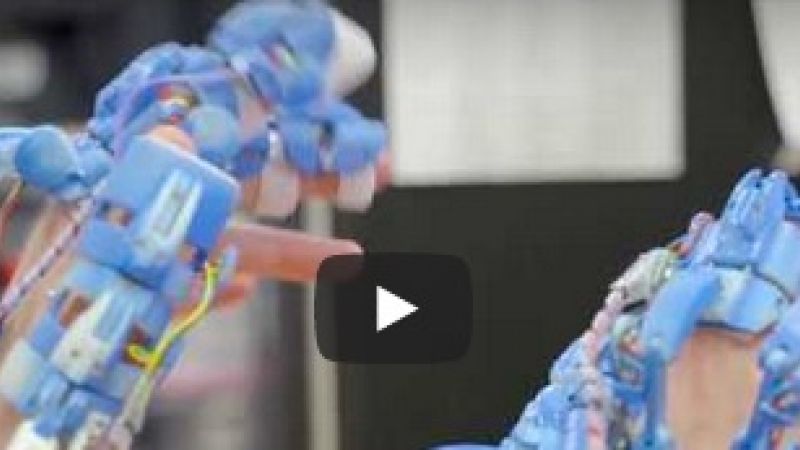 Robot assisted surgery