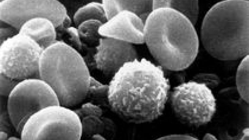 Myeloid leukaemia slowed in mice