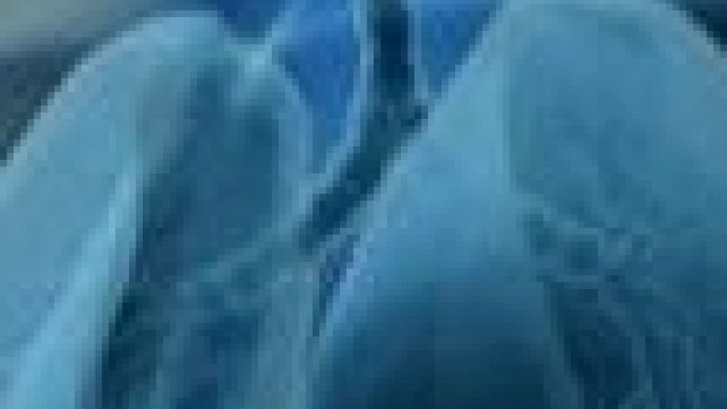 Understanding Asthma