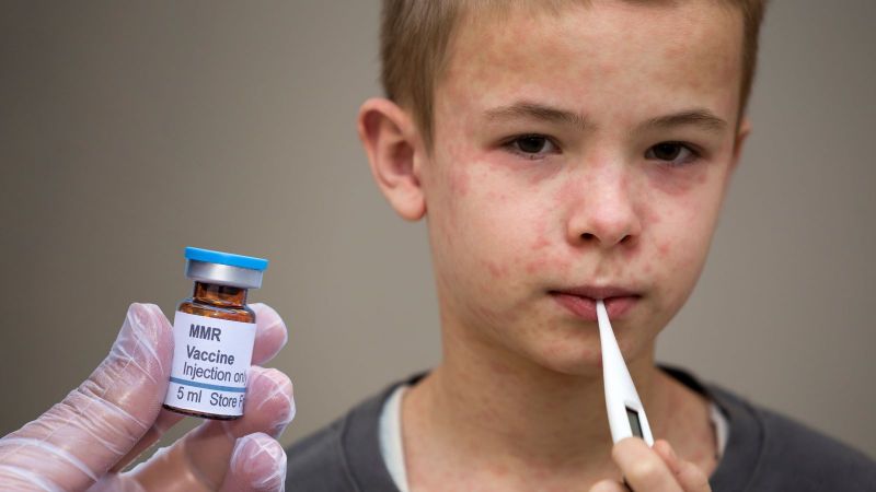 Is the measles vaccine safe?