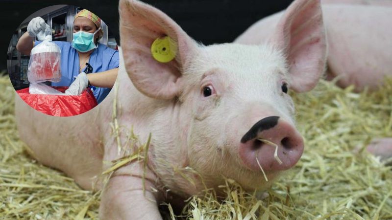 The science behind pig to human organ transplants