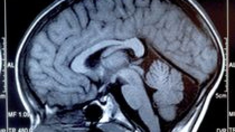 Brain cancer research suggests new treatments
