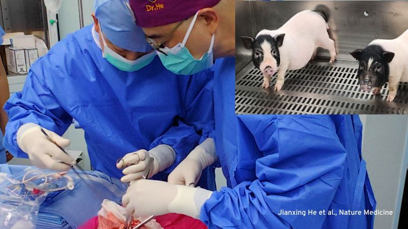 The science behind the first pig-to-human lung transplant