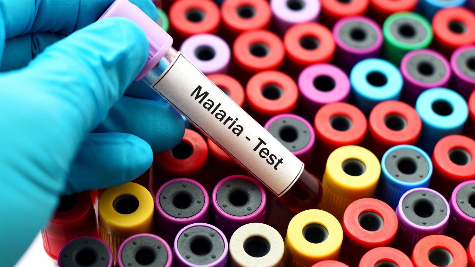 Sickle cell protects against Malaria