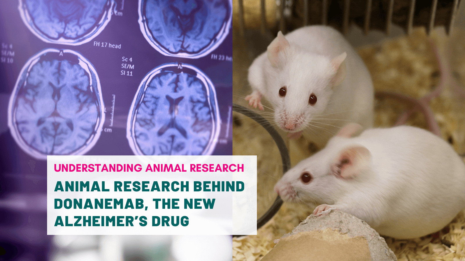 Animal research behind Donanemab, the new Alzheimer’s drug