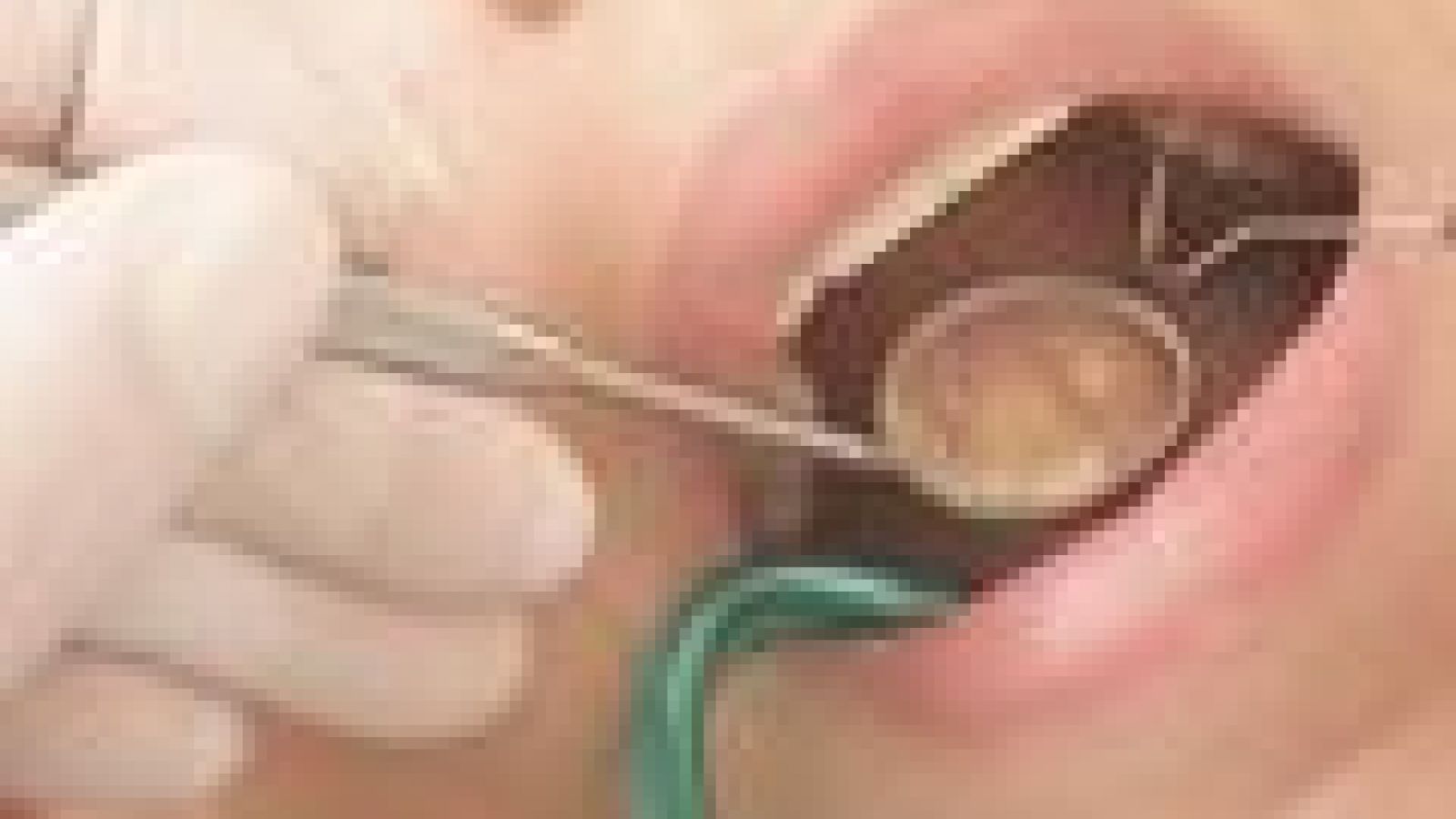 Gene controls formation of tooth enamel