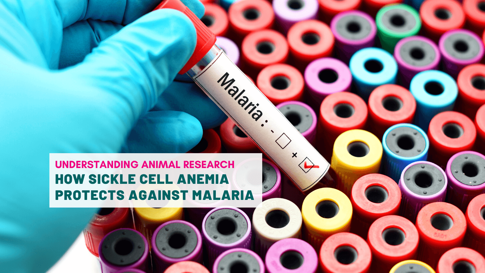 How sickle cell protects against Malaria